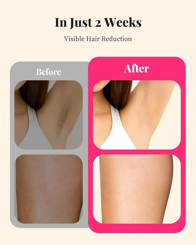 LYSMOSKI Laser Hair Removal for Women and Men, At-Home Use IPL Hair Removal Device with 5.2 cm² Treatment Window, Nearly Painless, Visible Results in 2 Weeks, Full Body Treatment in 8 Minutes, White