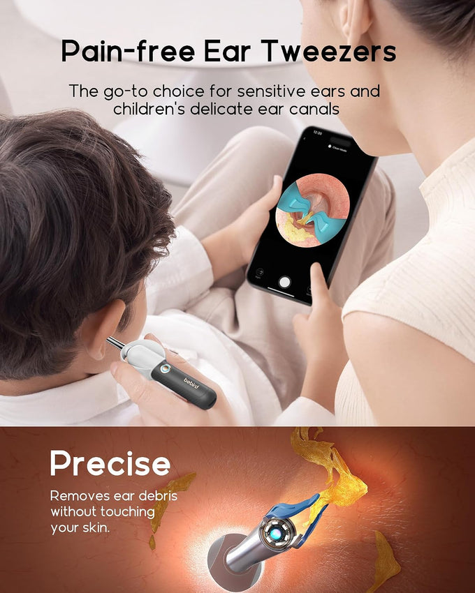 Bebird R37R Ear Wax Removal Tool Camera, Flexible Scope and Visual Tweezers