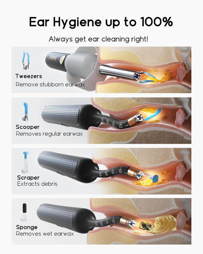 Bebird R37R Ear Wax Removal Tool Camera, Flexible Scope and Visual Tweezers